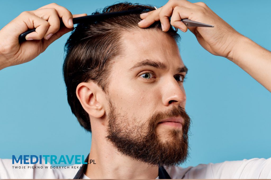 Przeszczep włosów w Turcji